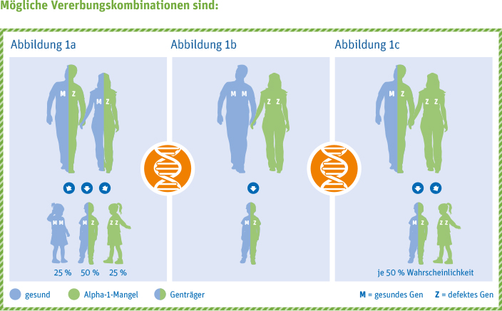 Das Vererbungsschema der Lungenkrankheit Alpha-1